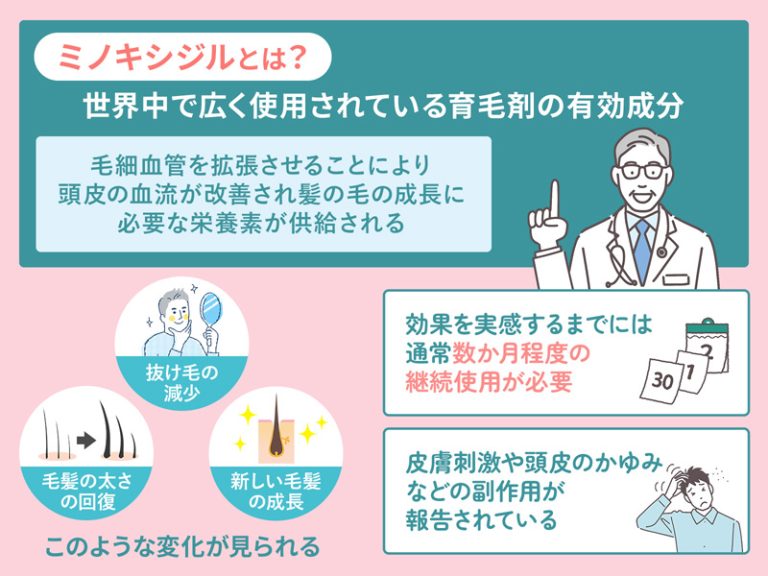 ミノキシジルについての図解